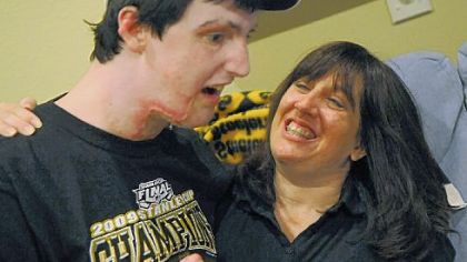 Kevin Kammerdiener's life was altered forever when a suicide bomber in Afghanistan slammed into his Humvee, killing two soldiers and seriously injuring him and another soldier.  His mother,
Leslie, left, says that in many ways caring for Kevin is like caring for a child again.